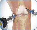 Arthroscopic & Soft Tissue 