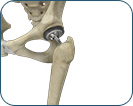 Arthroscopic & Soft Tissue 